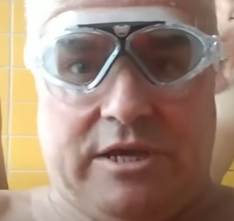 Bald Image